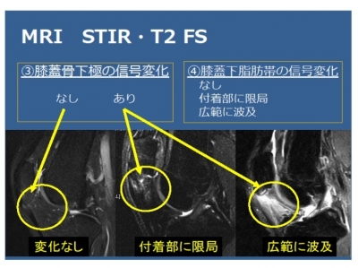 b_400_299_16777215_00_images_金森先生画像_図2.jpg