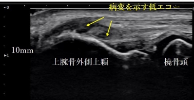 b_400_206_16777215_00_images_岩堀先生画像_図1.jpg