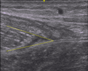 b_300_242_16777215_00_images_佐竹先生画像_図3a.png