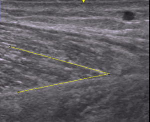 b_300_245_16777215_00_images_佐竹先生画像_図3b.png